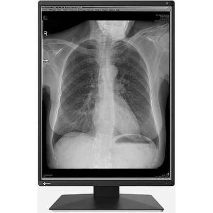 EIZO RadiForce RX250 22" Class LCD Monitor - 3:4 - Black