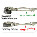 Evoluent VerticalMouse 4 Right Bluetooth Technology (NO DONGLE REQUIRED)